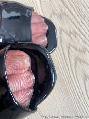 explosivetoess Nagie Wycieki OnlyFans Zdjęcie 34