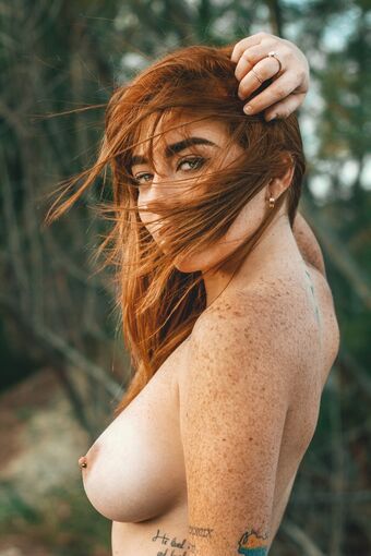 Freckles