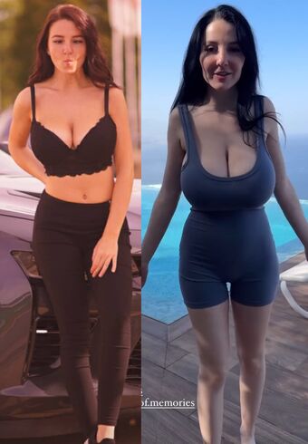 Growing Breasts
