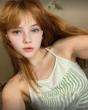 mi_ameli